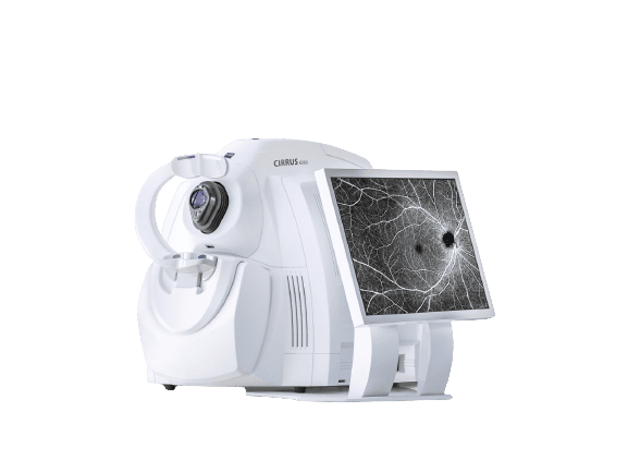 Tomographie par cohérence optique (OCT)
